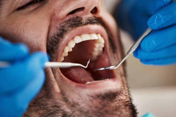 Laser Dentistry in Norwood, OH